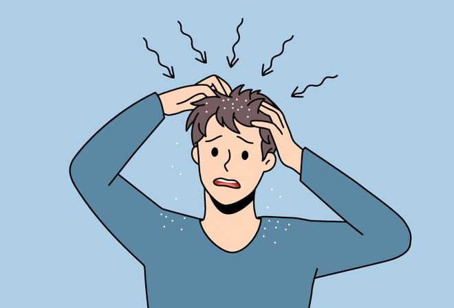 【首都除夕护卫健康】科普 脂溢性皮炎是怎么回事儿？