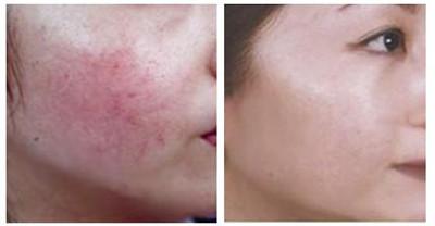 常州市武进人民医院